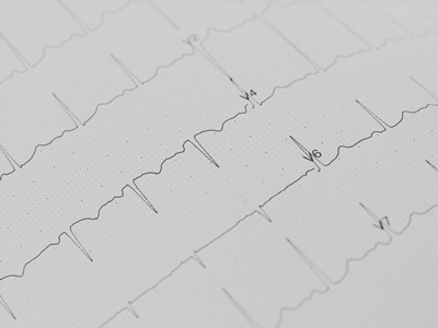 herz zehn kardiologie innere medizin 1100 wien ekg 2